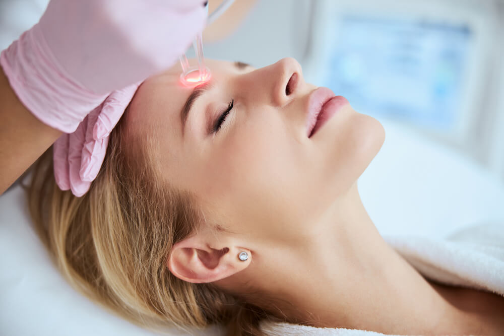 laser skin treatment