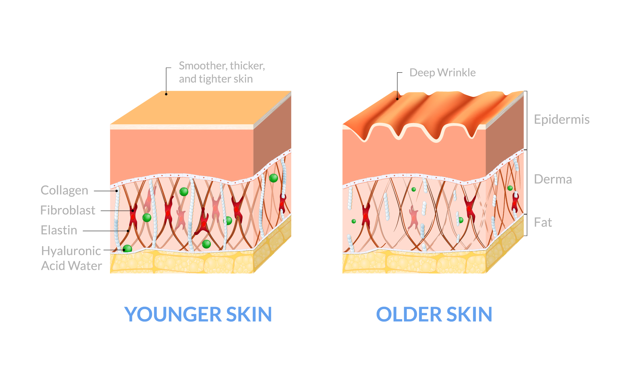 LIPOcel Body Sculpting 101: Understanding How It Works - Elite