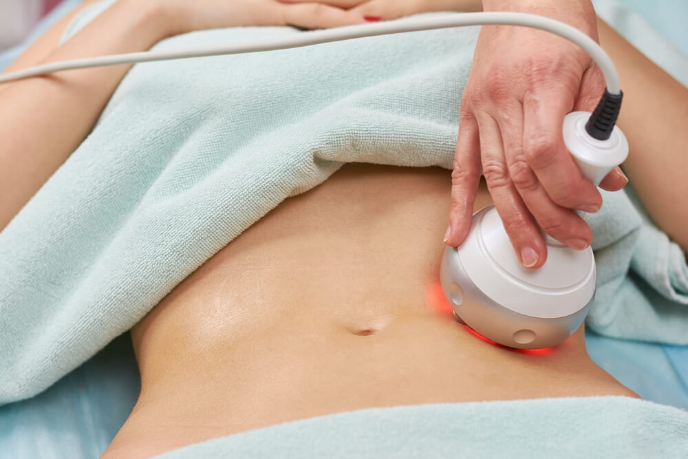 Could Radio Frequency (RF) Body Treatments Give You the Silhouette of Your  Dreams? – Introlift Medical Spa