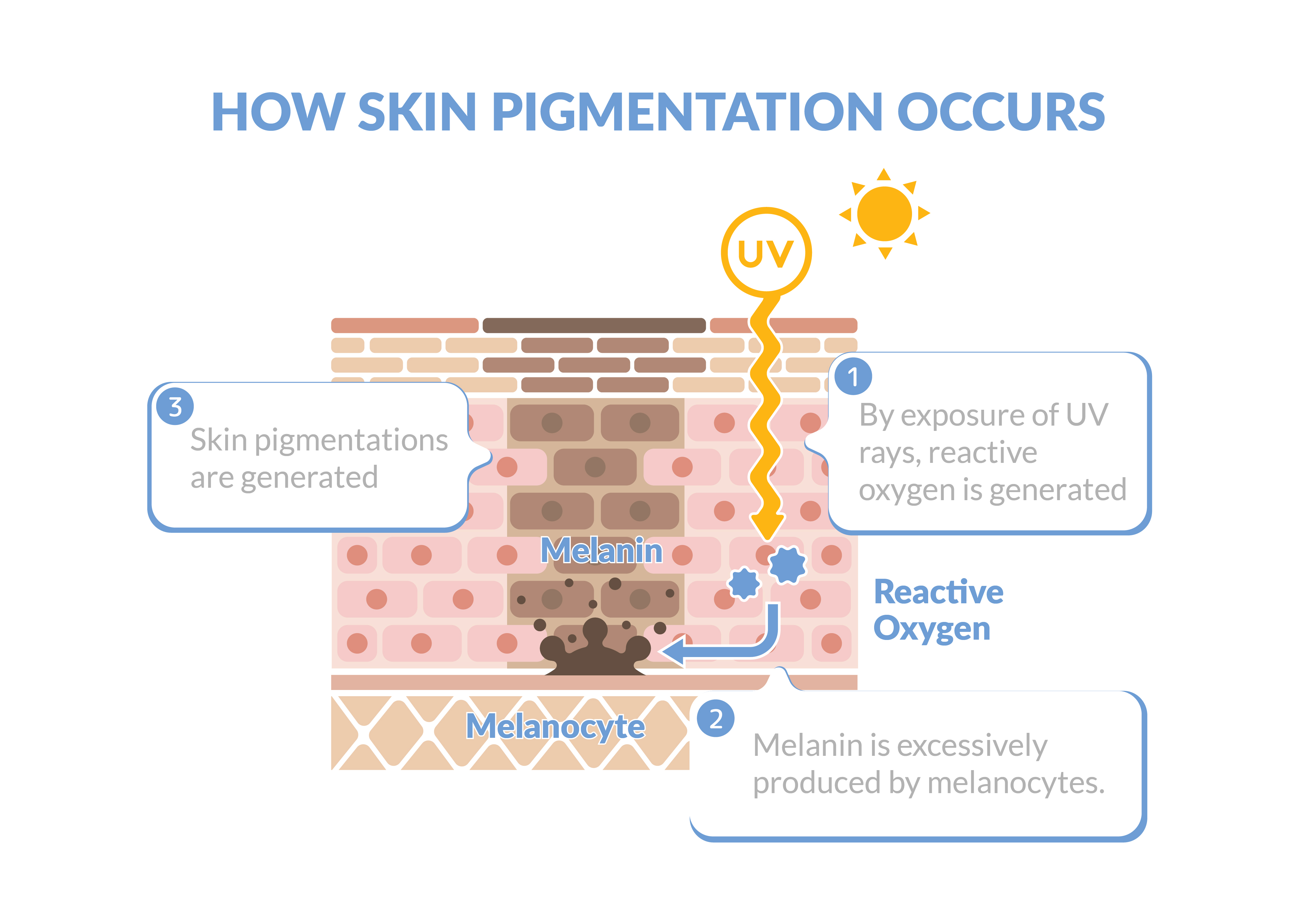 Skin Pigmentation Treatment - by laser dermatologist Dr Davin Lim